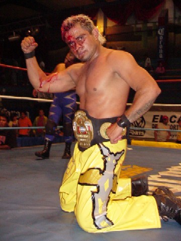 File:Iwrgwelter cerebronegro.jpg