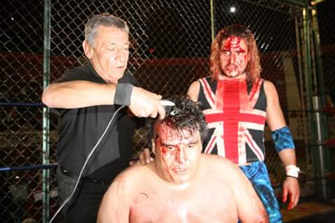 File:Brazo de platino cabellera.jpg